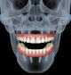 Dental implanter skull images with teeth