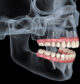 Top Dental Clinics in Mumbai offering advanced dental implant treatment