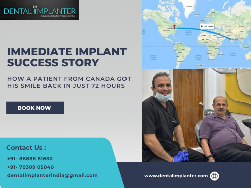 Dental implant | Immediate Implant