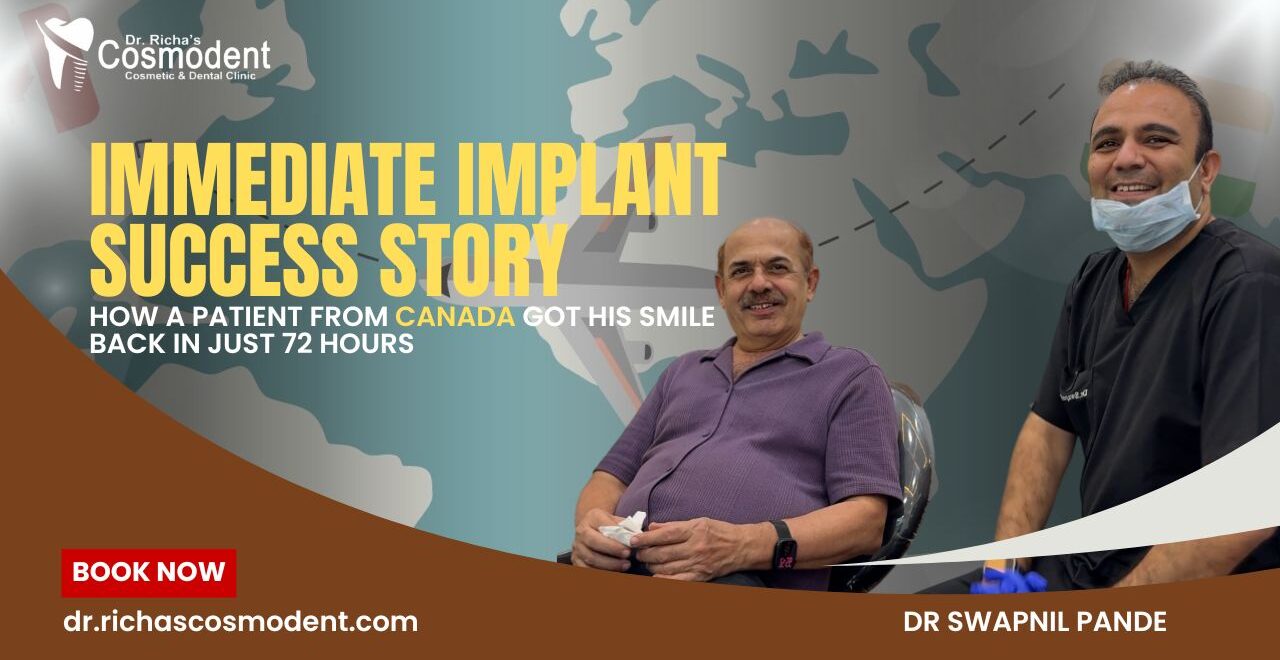 immediate Implant
