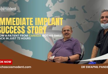 immediate Implant
