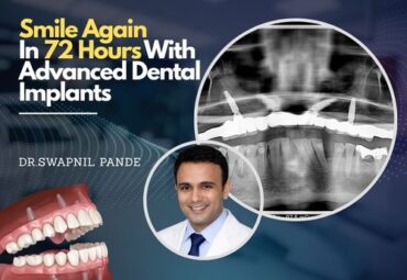 Advertisement banner showing the text 'Smile Again In 72 Hours With Advanced Dental' alongside a dental X-ray image, partially obscured by a gray overlay.