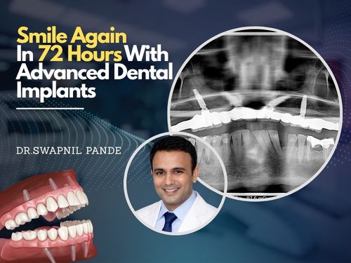 Advertisement banner showing the text 'Smile Again In 72 Hours With Advanced Dental' alongside a dental X-ray image, partially obscured by a gray overlay.