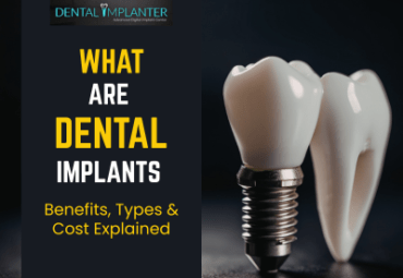 Illustration of a dental implant with a crown next to a natural tooth, with text “What Are Dental Implants – Benefits, Types & Cost Explained” on a dark background.