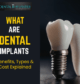 Illustration of a dental implant with a crown next to a natural tooth, with text “What Are Dental Implants – Benefits, Types & Cost Explained” on a dark background.