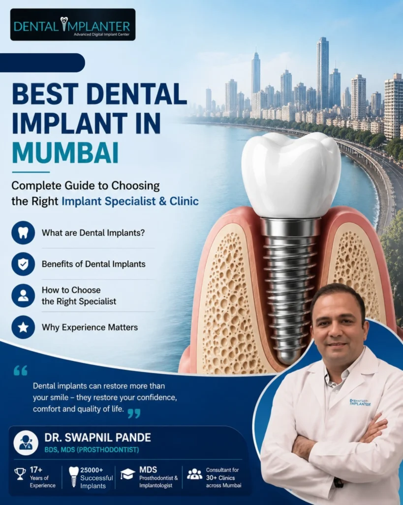 Best dental implant in Mumbai guide featuring Dr. Swapnil Pande, MDS Prosthodontist, explaining dental implants, benefits, choosing the right implant specialist, and advanced implant treatment at Dental Implanter.