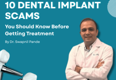 Banner image titled “10 Dental Implant Scams You Should Know Before Getting Treatment” featuring Dr. Swapnil Pande in a white dental coat standing with folded arms on a blue background, along with dental implant illustrations.