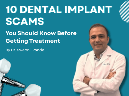 Banner image titled “10 Dental Implant Scams You Should Know Before Getting Treatment” featuring Dr. Swapnil Pande in a white dental coat standing with folded arms on a blue background, along with dental implant illustrations.