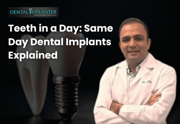Dr. Swapnil Pande explaining teeth in a day same day dental implants treatment at DentalImplanter Mumbai