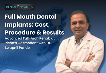 Full Mouth Dental Implants cost procedure and results by Dr. Swapnil Pande at Dental Implanter Mumbai