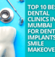 Top 10 Best Dental Clinics in Mumbai for Dental Implants & Smile Makeovers