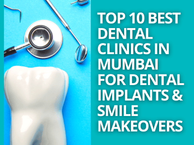 Top 10 Best Dental Clinics in Mumbai for Dental Implants & Smile Makeovers
