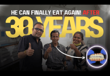 Successful full mouth dental implants in Mumbai by Dr. Swapnil Pande helping a patient eat comfortably again after 30 years