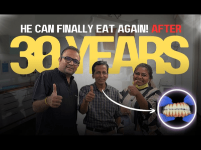Successful full mouth dental implants in Mumbai by Dr. Swapnil Pande helping a patient eat comfortably again after 30 years