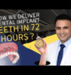 Dr. Swapnil Pande explaining the Implant in 72 Hours procedure, featuring advanced dental implants, a full-arch prosthetic model, and modern digital dentistry technology for fast smile restoration in Mumbai.