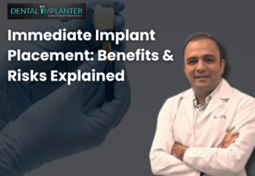 Discover immediate implant placement benefits, risks, and candidacy. Visit Dental Implanter for the best dental implants in Mumbai by Dr. Swapnil Pande.