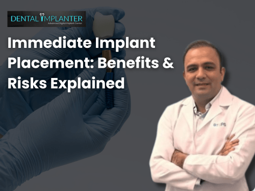 Discover immediate implant placement benefits, risks, and candidacy. Visit Dental Implanter for the best dental implants in Mumbai by Dr. Swapnil Pande.